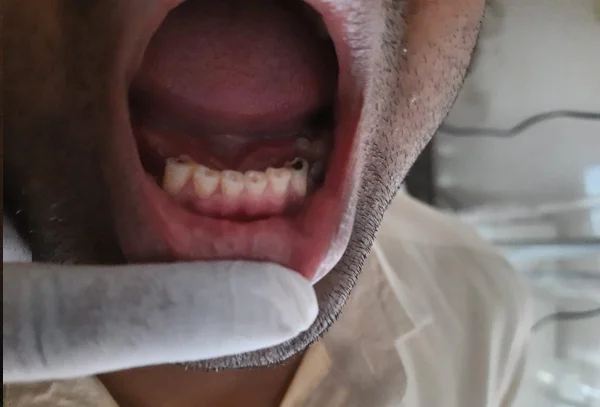 Chandra Dentcare and Cure