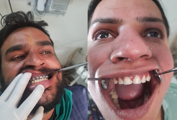 Chandra Dentcare and Cure