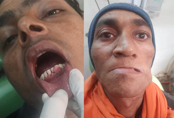 Chandra Dentcare and Cure