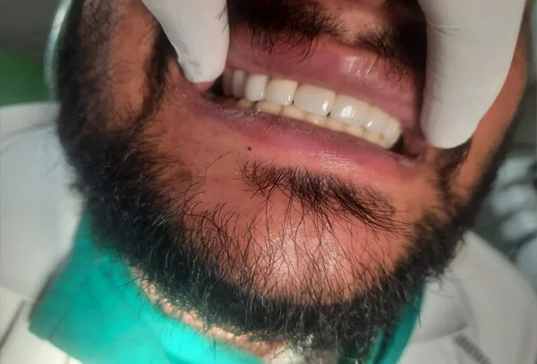Chandra Dentcare and Cure