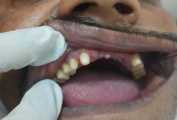 Chandra Dentcare and Cure
