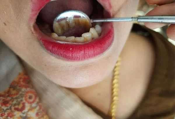 Chandra Dentcare and Cure
