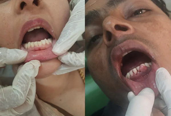 Chandra Dentcare and Cure