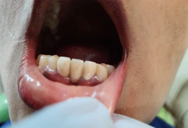 Chandra Dentcare and Cure