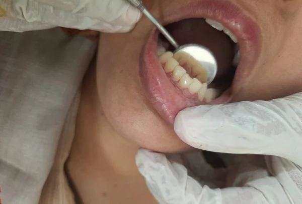 Chandra Dentcare and Cure