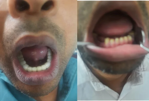 Chandra Dentcare and Cure
