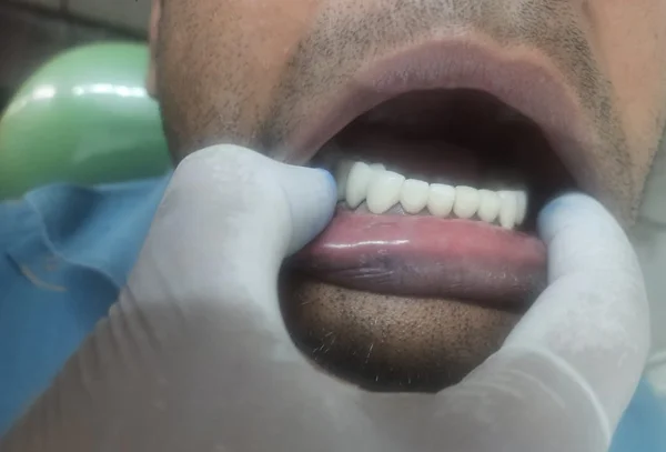 Chandra Dentcare and Cure