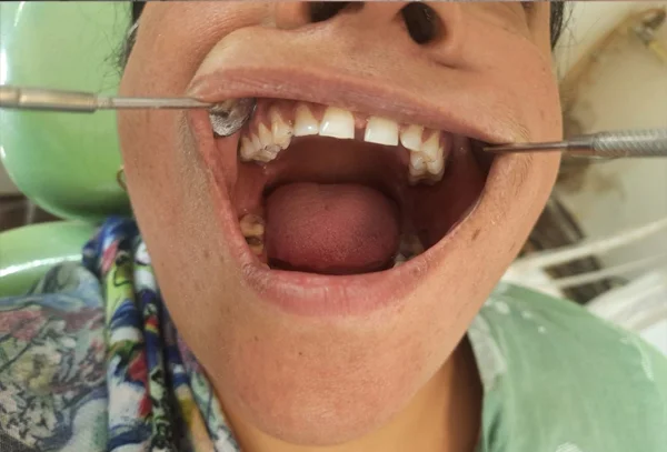 Chandra Dentcare and Cure