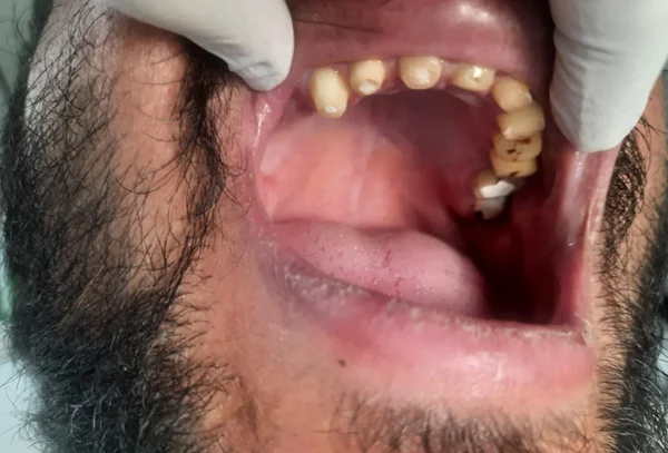 Chandra Dentcare and Cure