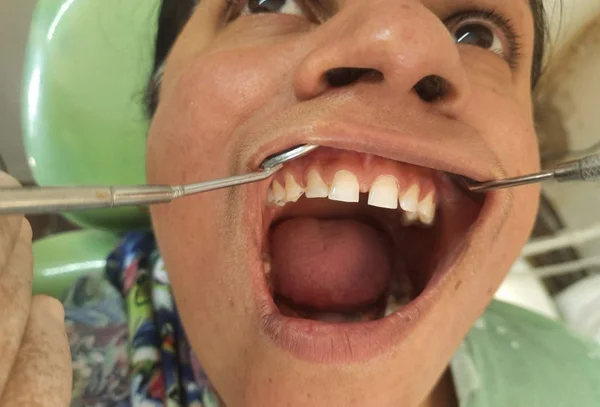 Chandra Dentcare and Cure