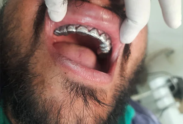 Chandra Dentcare and Cure