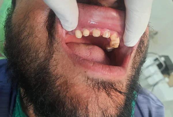 Chandra Dentcare and Cure