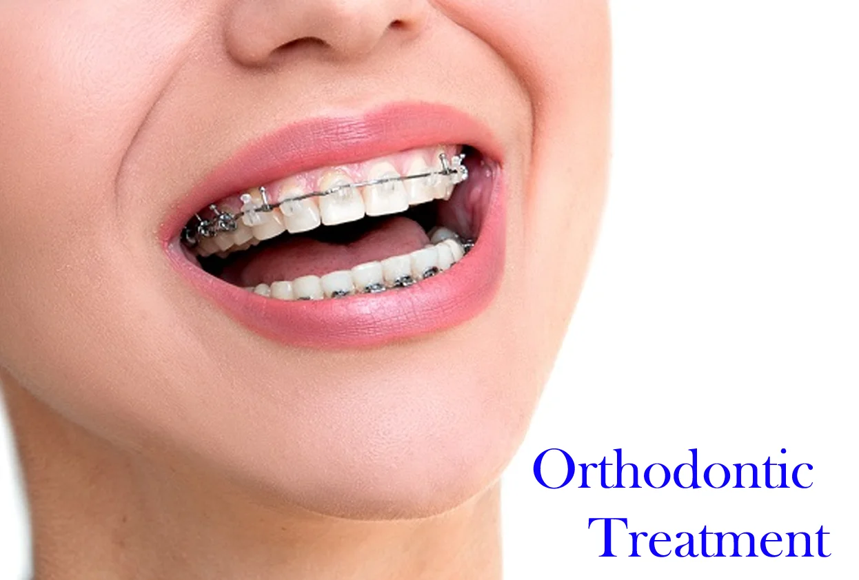 Orthodontics Treatment